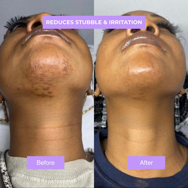 Natural Hair Reduction Oil